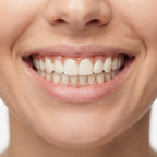Comfortable Reusable Silicone Denture Set With Natural Fit For Upper And Lower Gums - Image 1